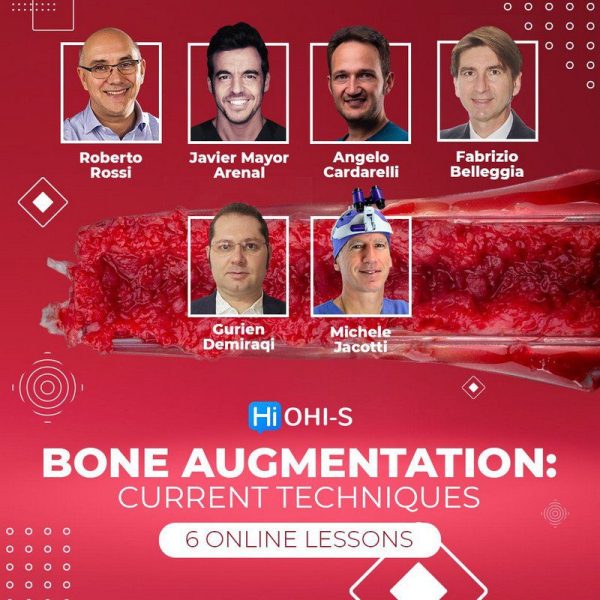 Bone Augmentation Current Techniques