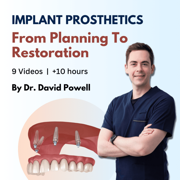 Implant Prosthetics from Planning to Restoration 1