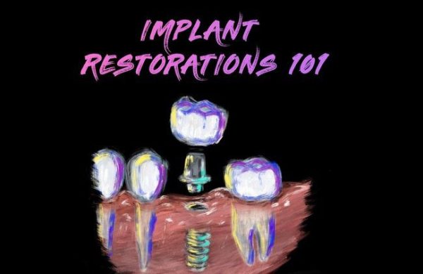 Implant Restorations 101