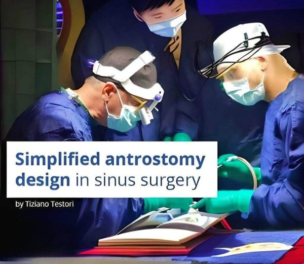 Simplified Antrostomy Design in Sinus Surgery fotor 2024052716856