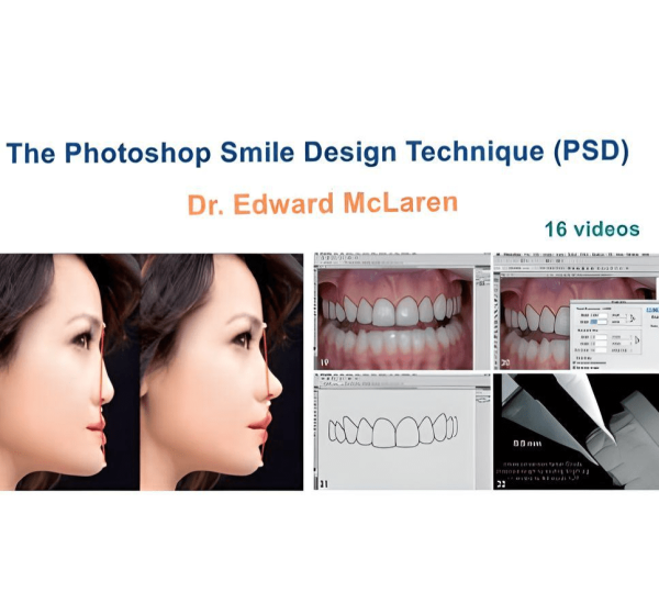 The Photoshop Smile Design Technique PSD fotor 2024052716248