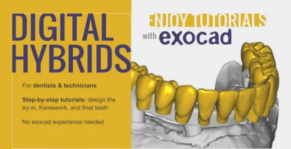 Digital Hybrids