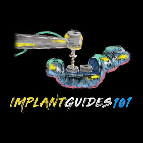 implant guides